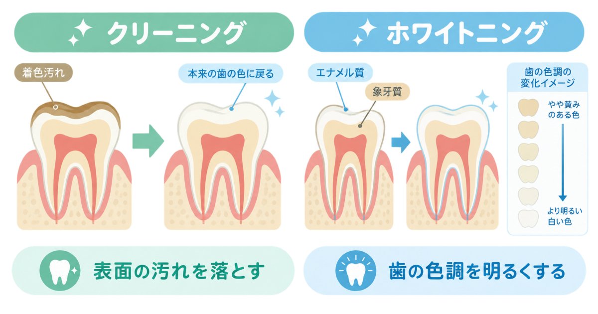 クリーニングとホワイトニング、歯の色はどう変わる?