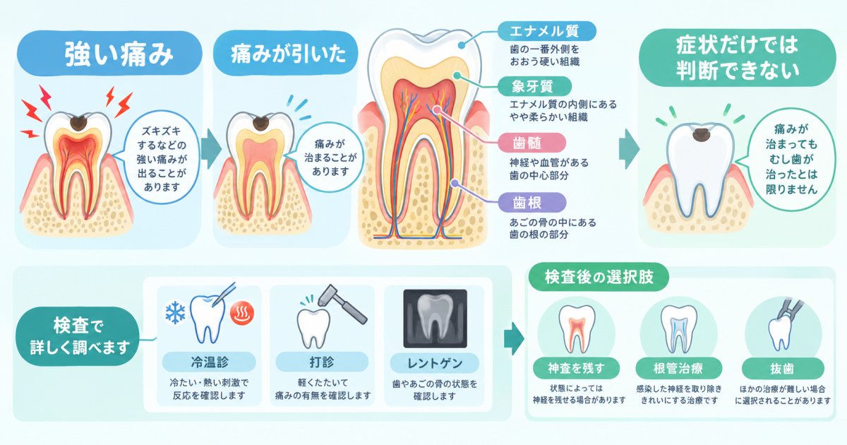 むし歯を放置後に痛みが引いたら？神経の状態と受診時期の目安